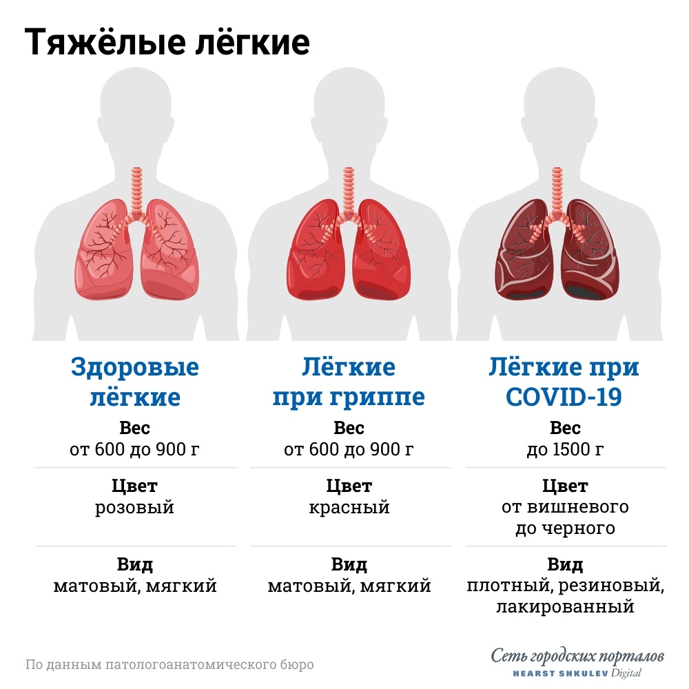 Пневмония у детей и взрослых: знания, которые спасут жизнь | правмир