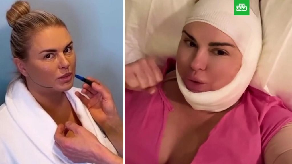 Анна Семенович опубликовала фотографию, сделанную в возрасте 17 лет Поклонники фигуристки были восхищены архивным снимком кумира