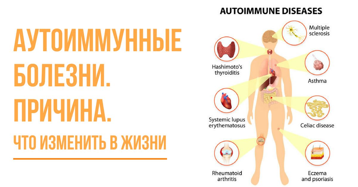 Болезнь часто приходит неожиданно, она поражает людей независимо от их социального статуса, занимаемой должности или известности В материале редакции — звезды с заболеваниями щитовидной железы