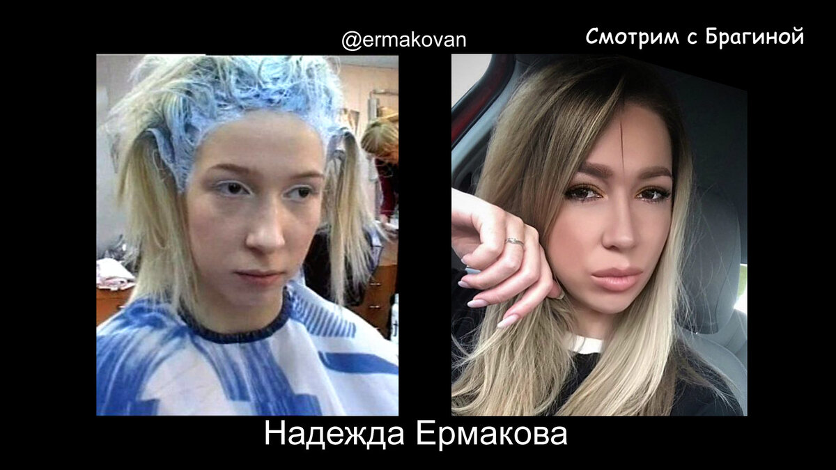 Надежда ермакова до и после пластики, фото, как выглядит сейчас 2023 (4 видео)